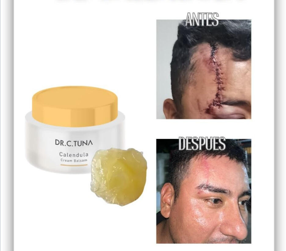 BÁLSAMO DE CALÉNDULA